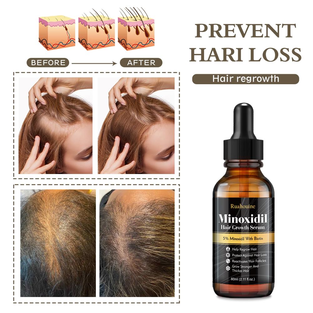 Biotin & 5% Minoxidil Hair Growth Serum Oil for Men & Women, 2.11 fl oz - Image 2