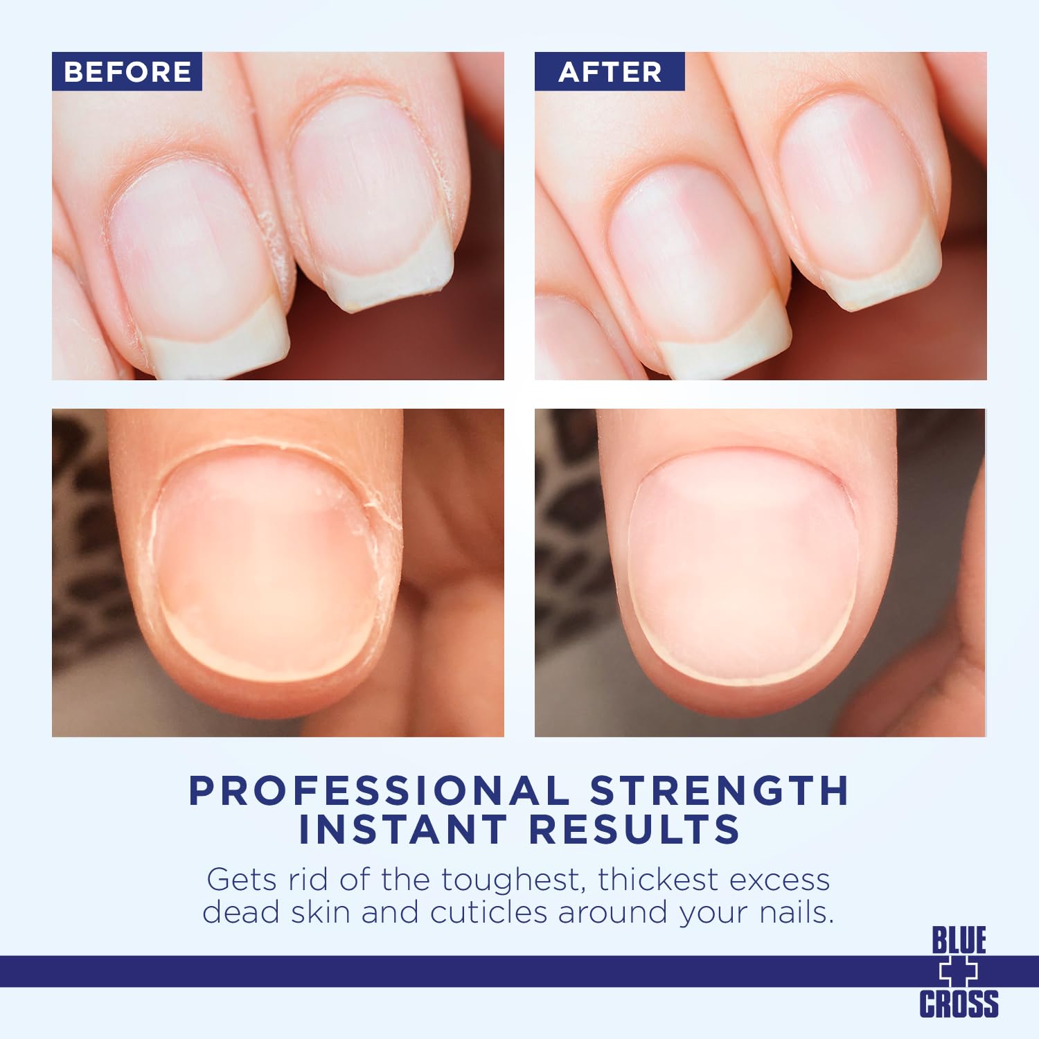 Blue Cross 2oz Cuticle Remover Cream for Dry Cuticles and Brittle Hang Nails - Image 2