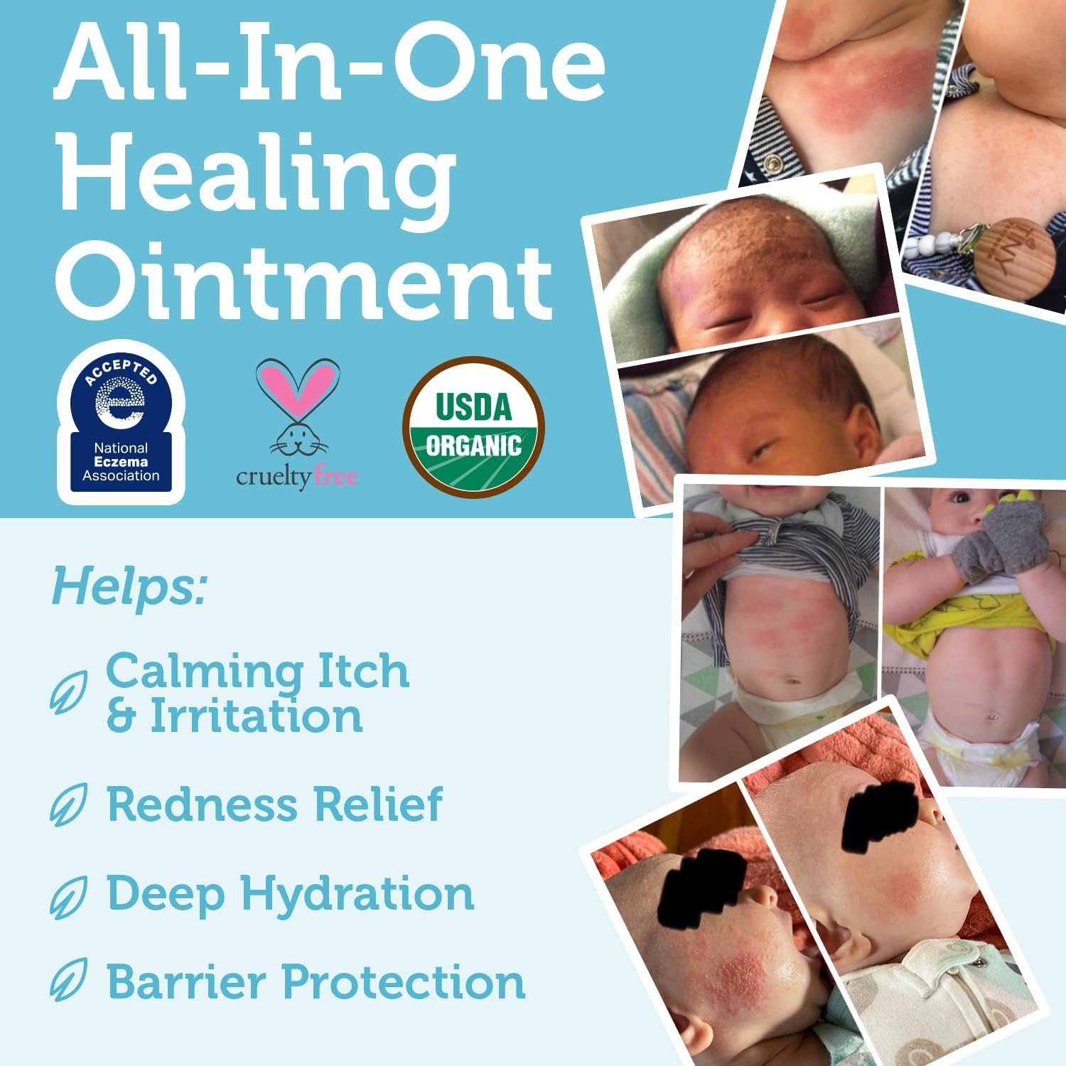 Era Organics USDA Organic Baby Healing Ointment 2 oz for Sensitive Skin - Image 5