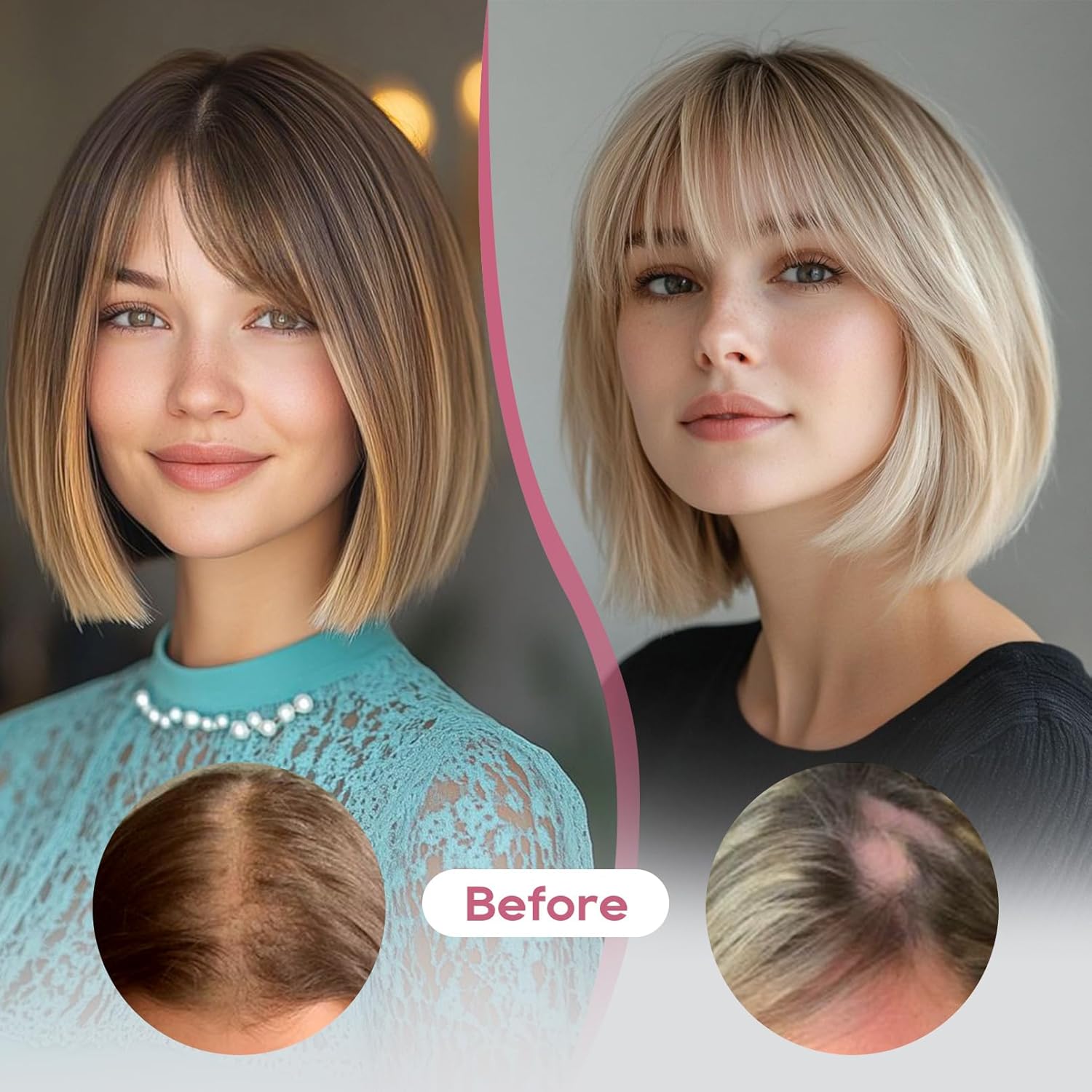 RECHO 360° Seamless Human Hair Topper with Bangs, Gray, 10" x 10" - Image 4
