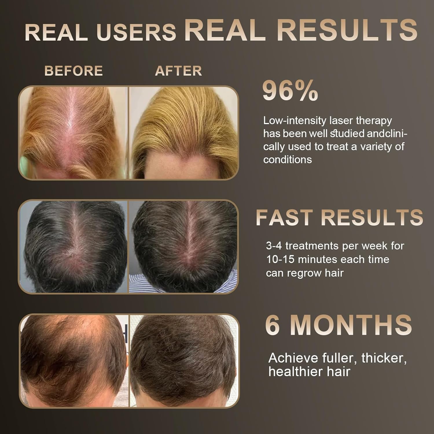 Handheld Laser Hair Growth Comb for Thicker, Healthier Hair Growth - Image 5