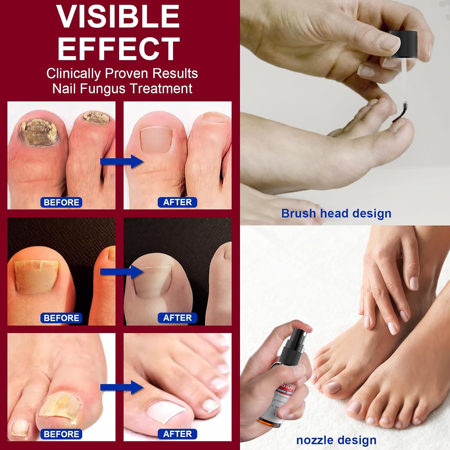 Extra Strength Toenail Repair Liquid for Damaged, Discolored Nails - 2 Pack - Image 4