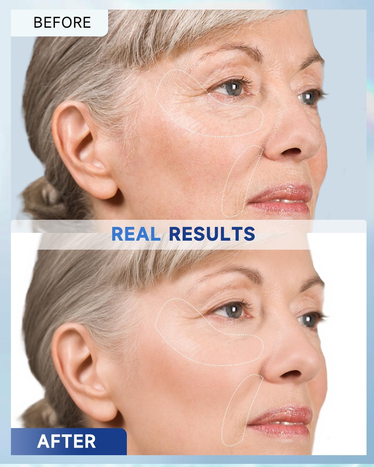 Retinol Face and Neck Cream with Collagen and Hyaluronic Acid 1.7 Fl Oz - Image 6