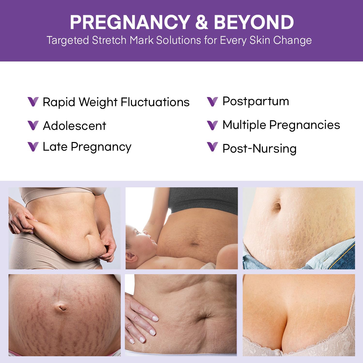 Pregnancy Belly Butter Stretch Mark Cream 4 Oz - Moisturizing Massage Lotion for Prevention and Repair - Image 4