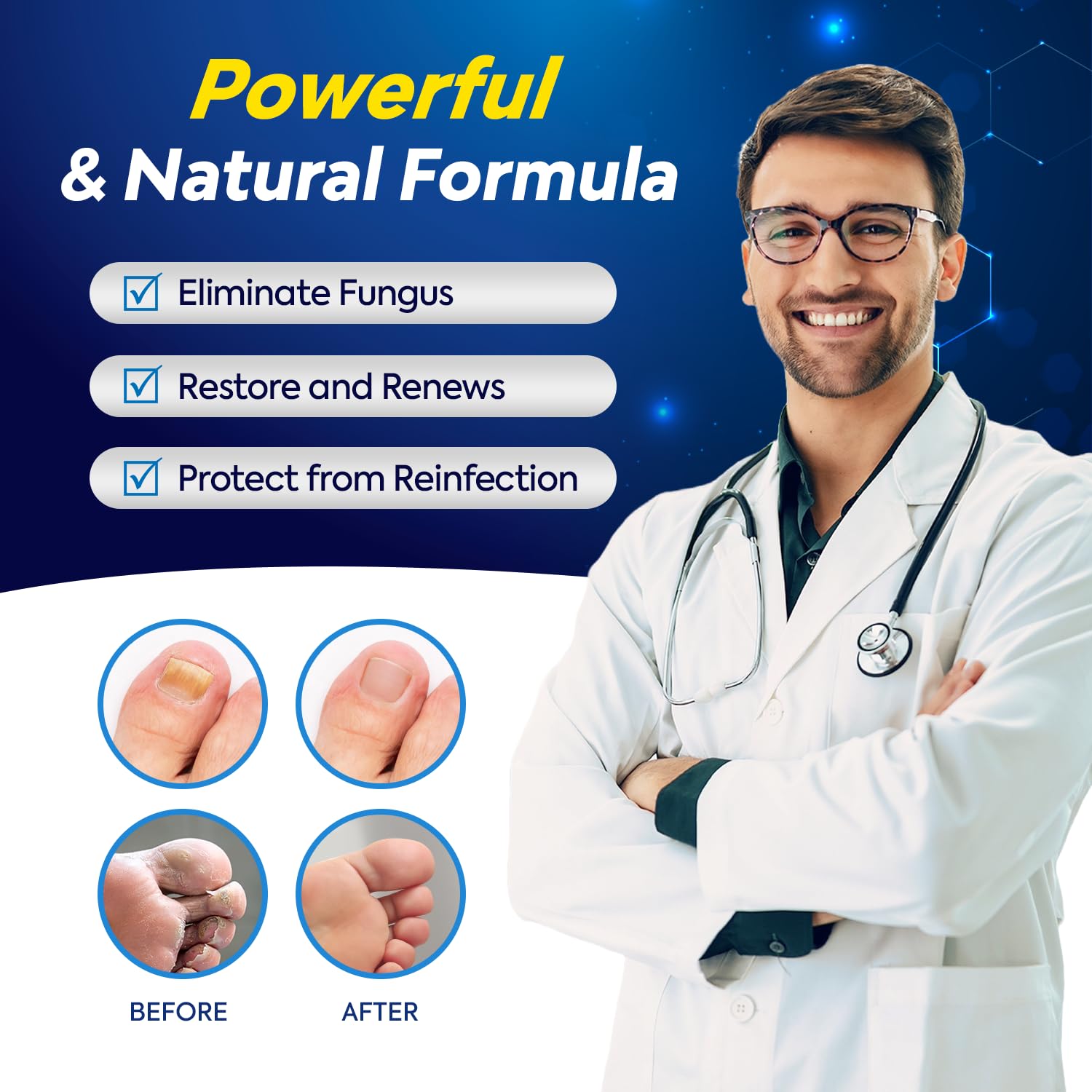 Extra Strength Toenail Fungus Treatment with 25% Undecylenic Acid, 1oz Fungal Nail Solution - Image 2