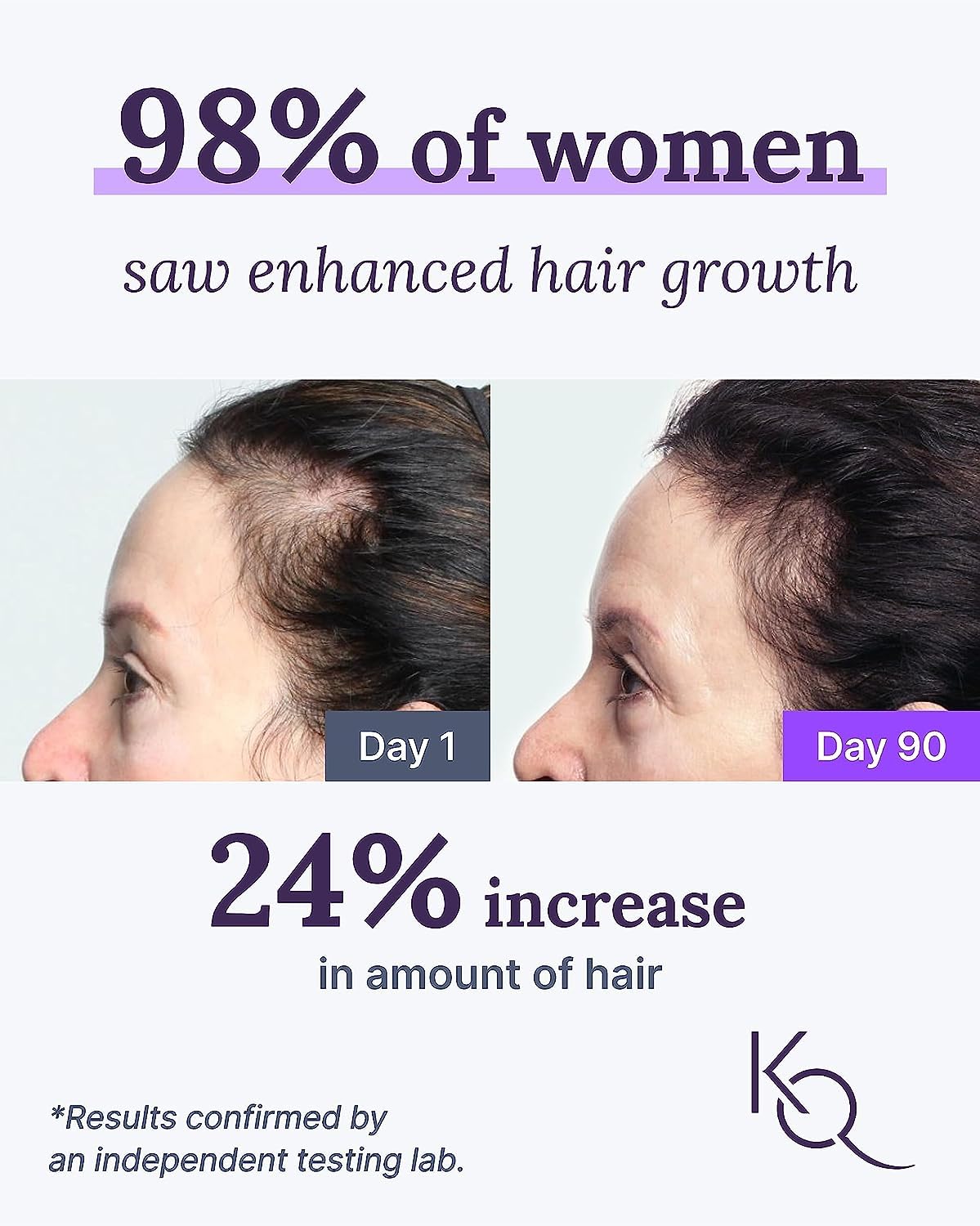 Keranique 30-Day Hair Growth System with KeraViatin Vitamins, Biotin, and Lift Spray - Image 2