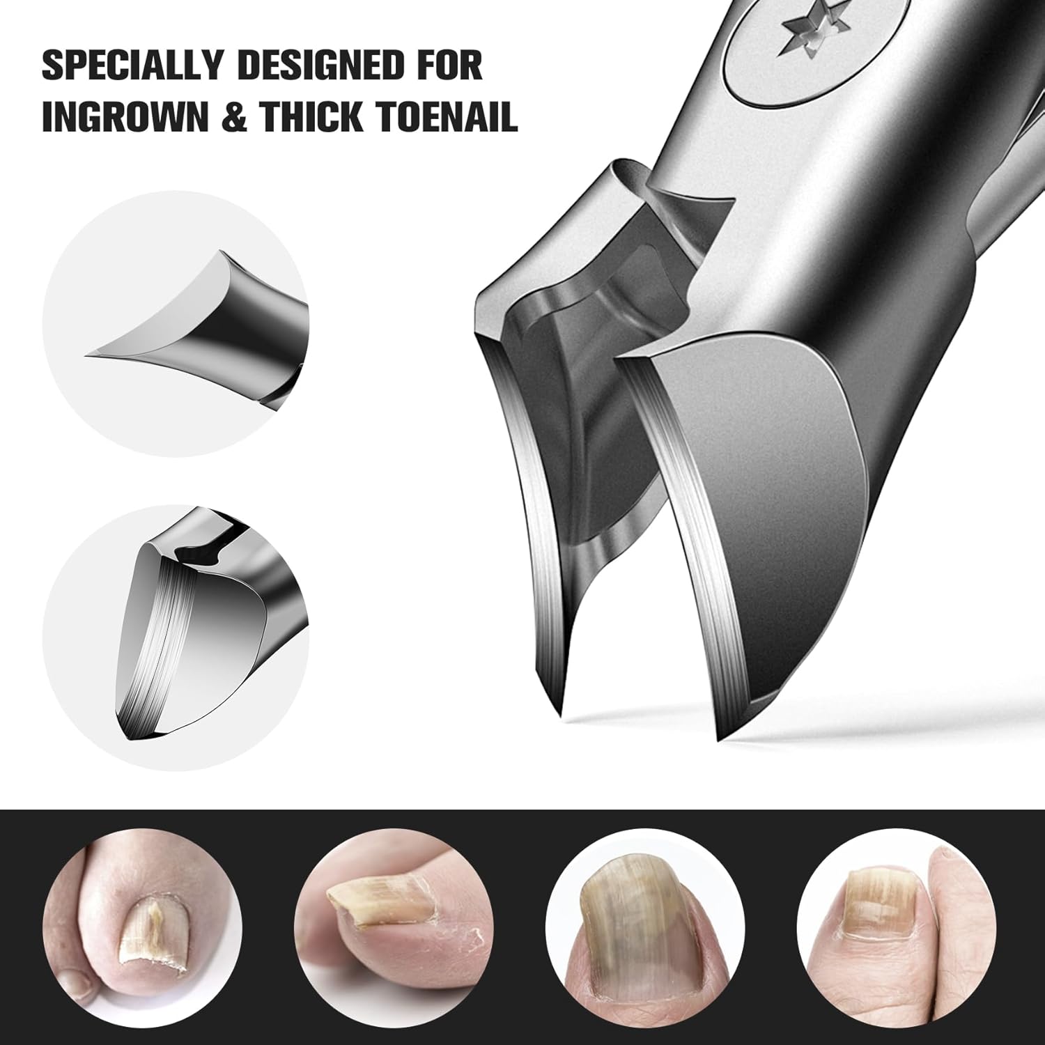 FERYES Stainless Steel Wide Jaw Thick Toenail Clippers with Catcher for Seniors - Image 4