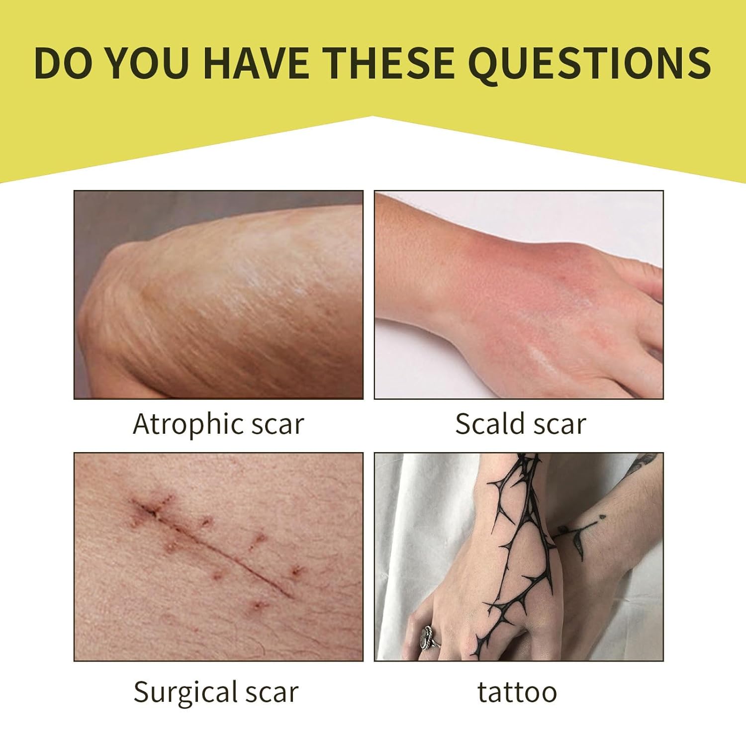 Ultra Thin Waterproof Tattoo Cover Up Tape - Breathable Skin Concealer Patch for Scars - Image 9