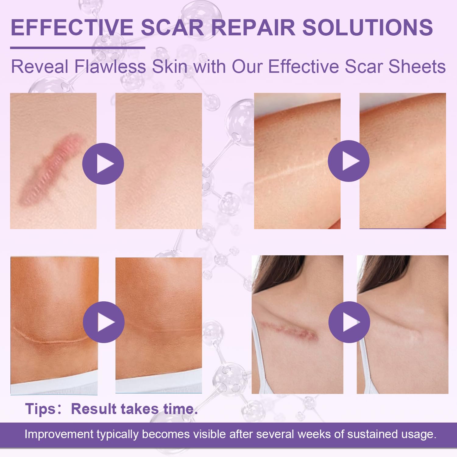 1.6"x 60" Silicone Scar Tape Roll for Surgery, Face, C Section, Burn, Acne Scars - Image 4