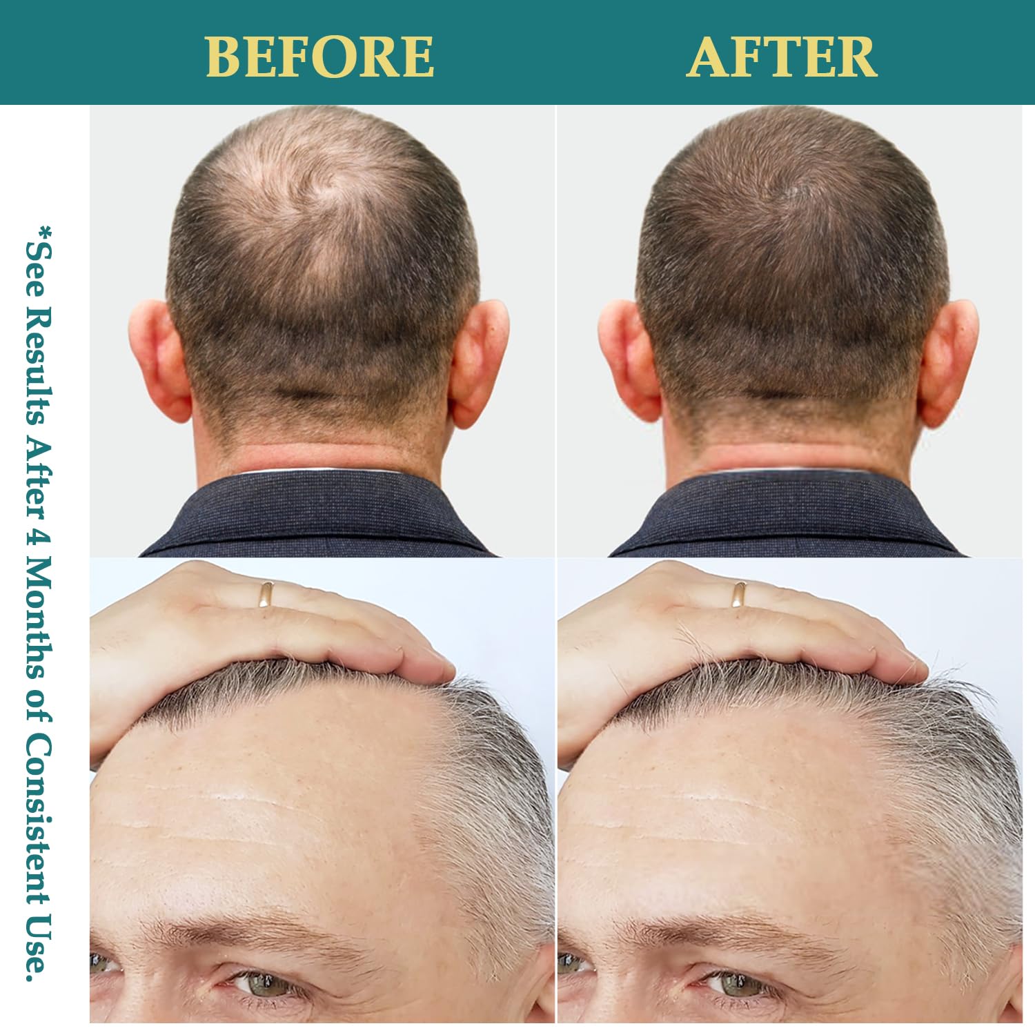 Natural Batana Rosemary Serum Biotin Caffeine Hair Growth Oil Spray 2 FL OZ for Thicker Hair. - Image 4