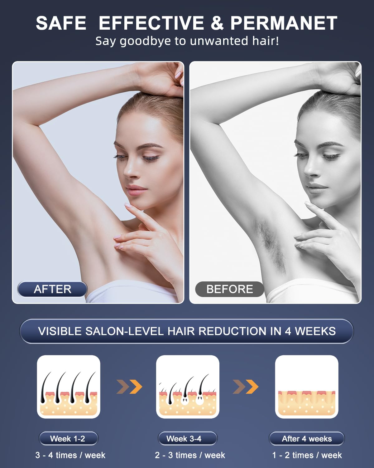 Professional IPL Laser Hair Removal Device 999999 Flashes for Home Use - Image 5