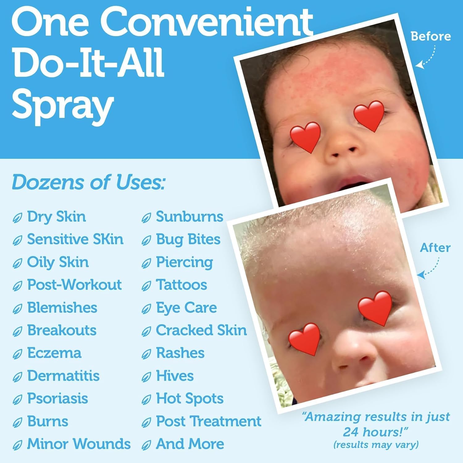 Happy Skin 2oz .02% Hypochlorous Acid Spray Toner for Face and Body Gentle Hydrating Cleanser - Image 3