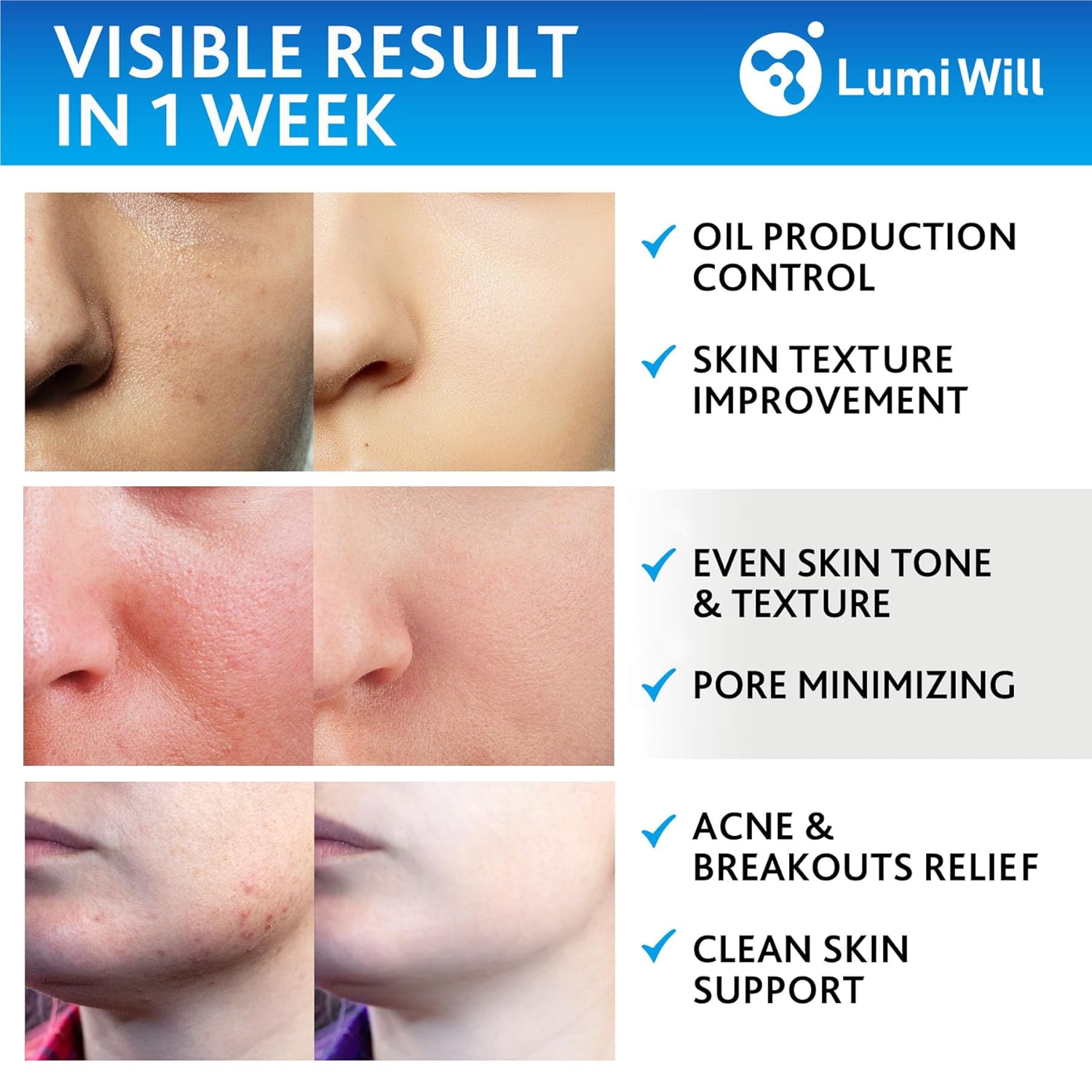 Glycolic Acid Exfoliating Pads with Vitamins B5, C, E & Menthol 50 Count for Acne Anti-Aging - Image 3