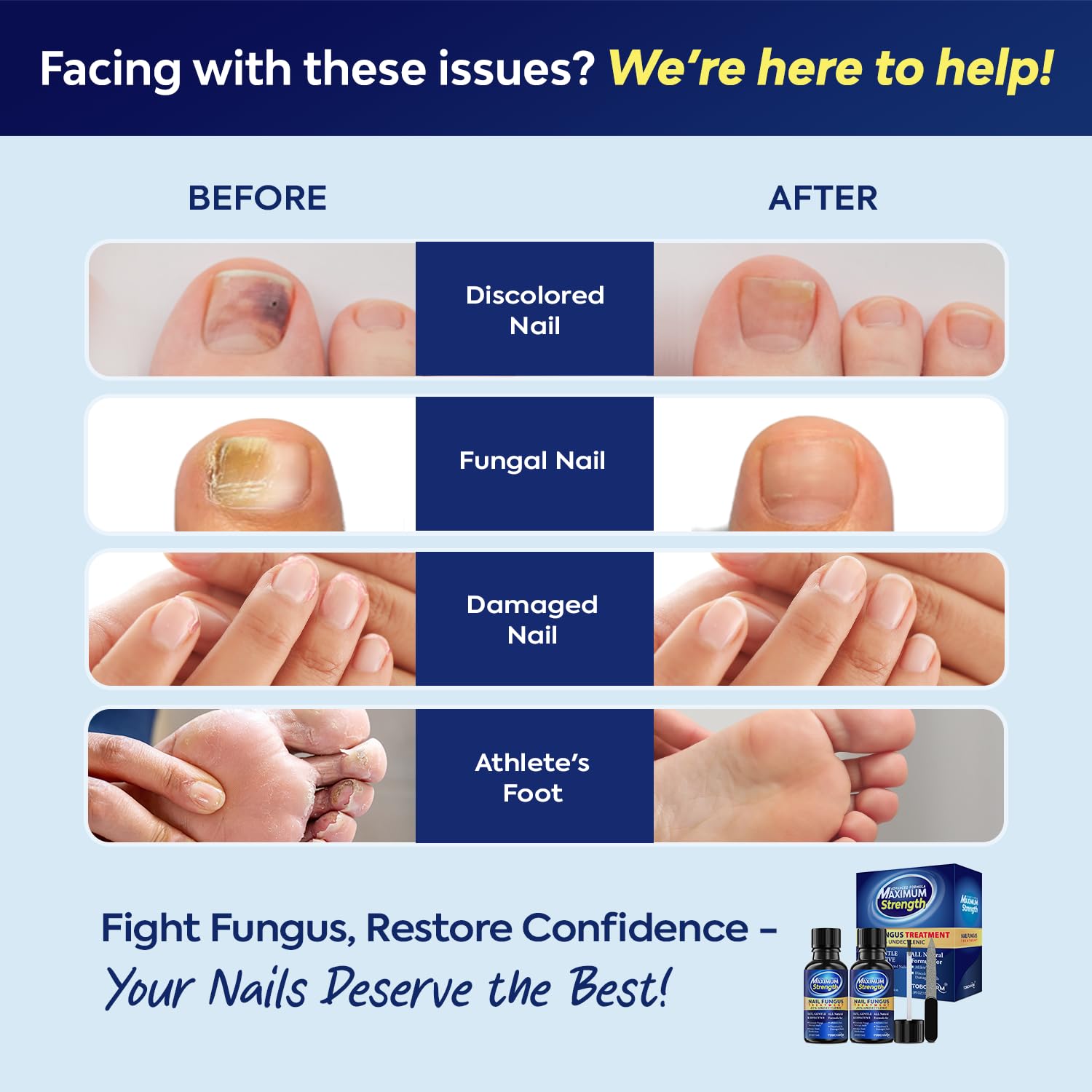 Extra Strength Toenail Fungus Treatment with 25% Undecylenic Acid, 1oz Fungal Nail Solution - Image 3
