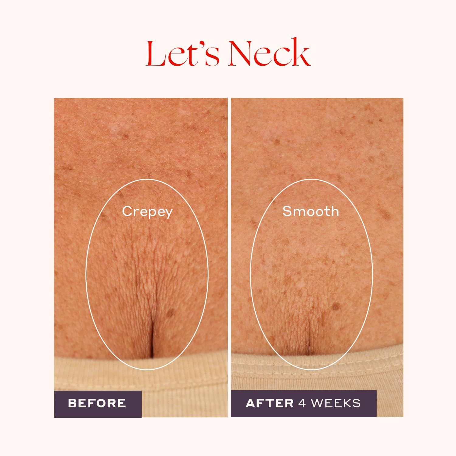 Womaness Let's Neck Firming Serum 50ml Roll On Cream for Neck Tightening Hydration - Image 3