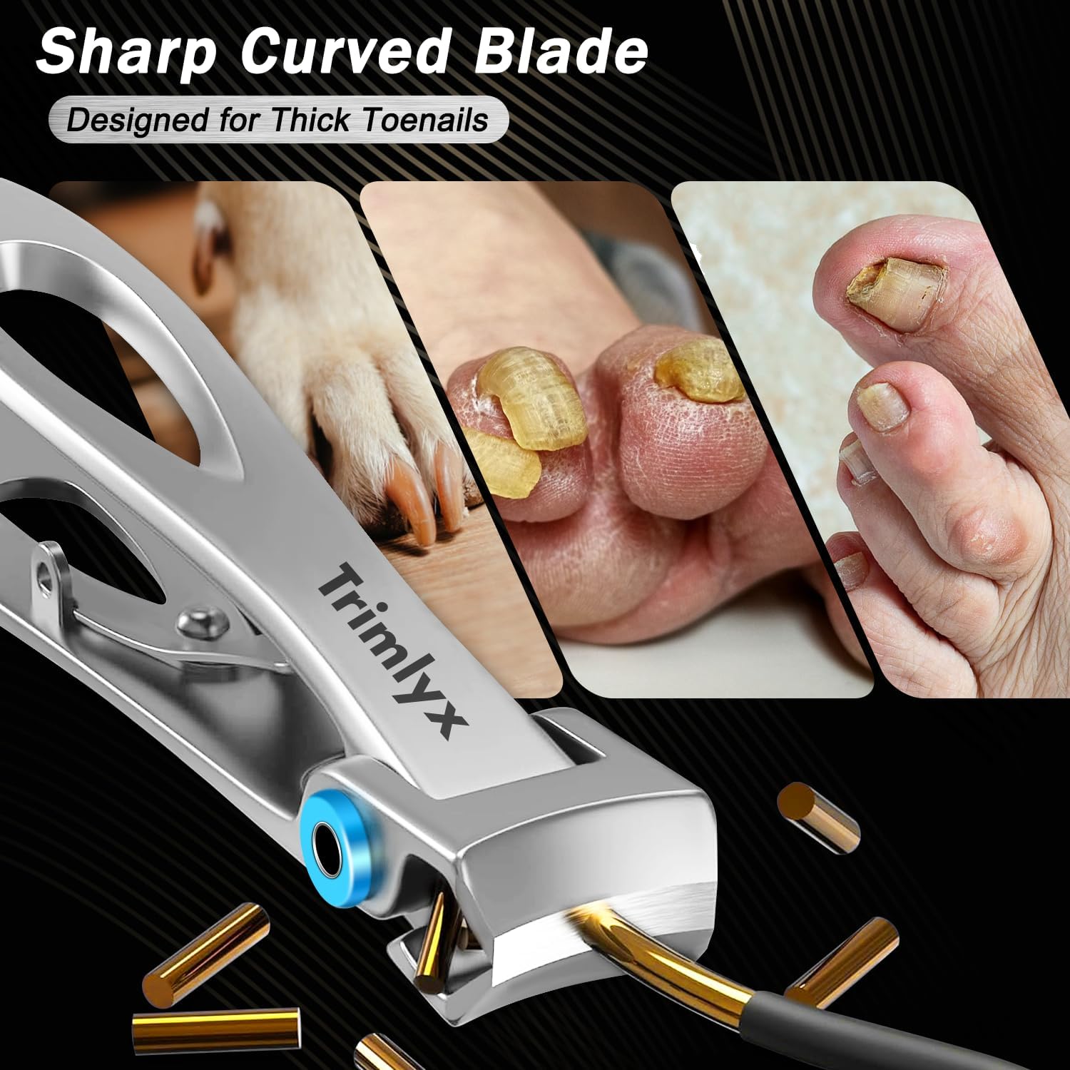 Trimlyx Heavy Duty Toenail Clippers 5-Piece Set for Thick Nails Seniors Men - Image 2