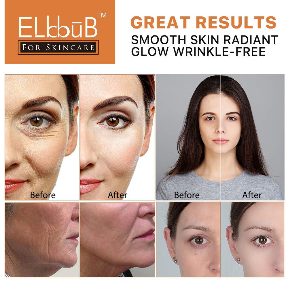 Revitalize Your Skin: 1oz Premium 20% Vitamin C Serum with Hyaluronic Acid and Retinol - Image 8