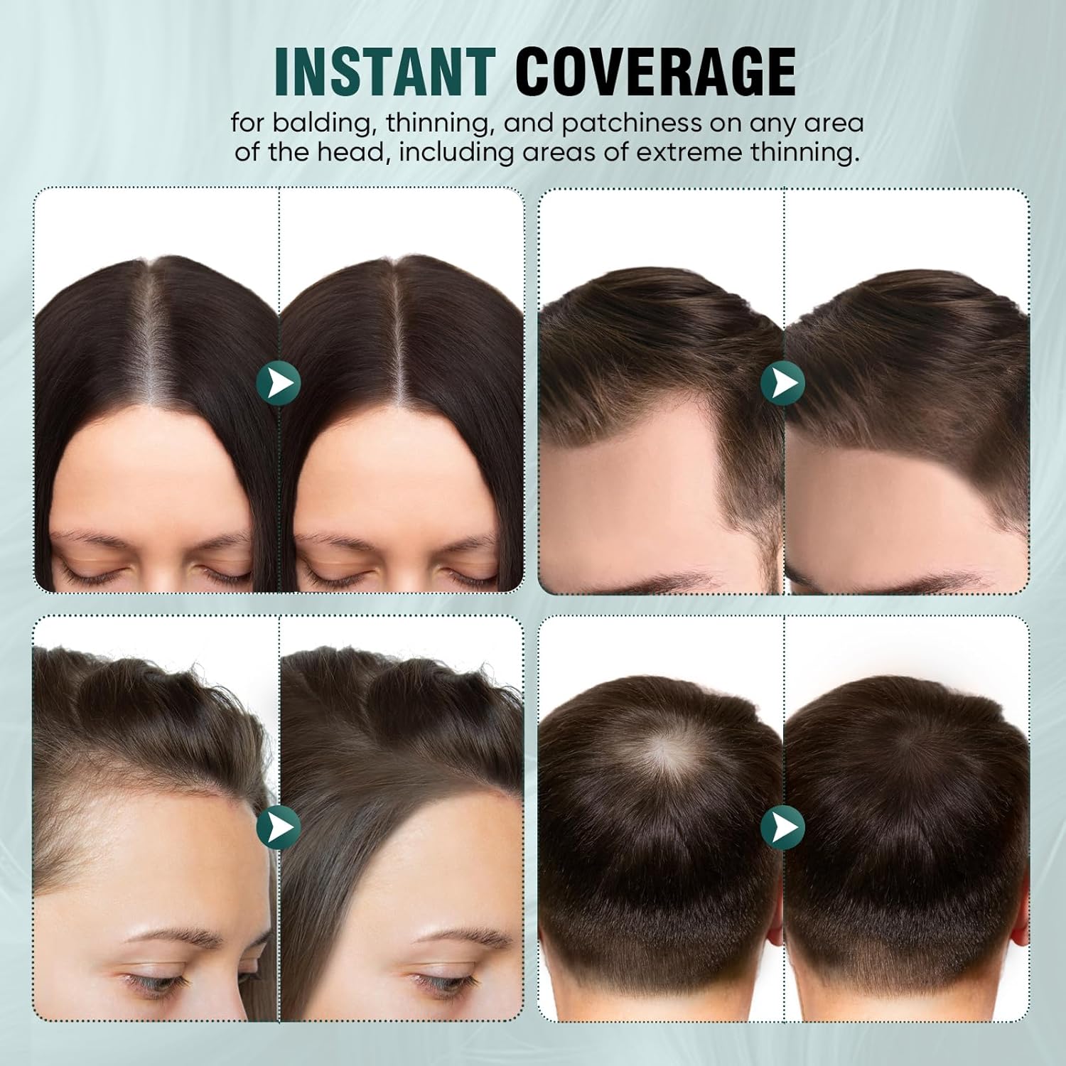 Hairline Powder 12g for Instant Hair Root Touch Up, Medium Brown Color Concealer with 2 Refills - Image 6