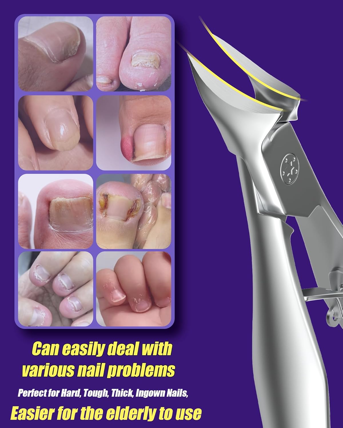 SZQHT Heavy-Duty Toenail Clippers for Thick Ingrown Nails Ultra Wide Jaw 13mm - Image 4