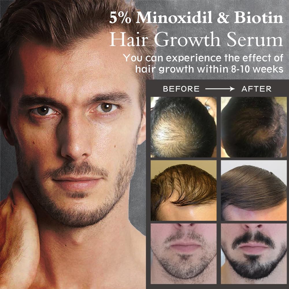 Biotin & 5% Minoxidil Hair Growth Serum Oil for Men & Women, 2.11 fl oz - Image 5