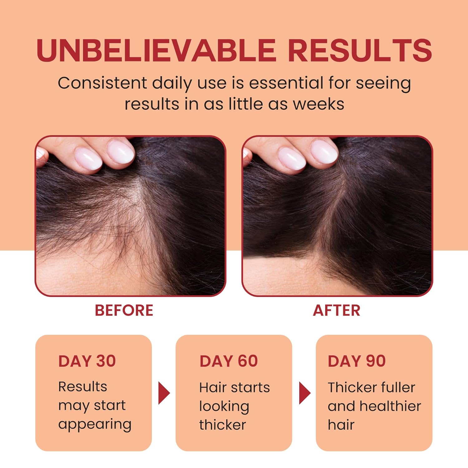 4oz 100% Pure Organic Raw Batana Oil Hair Growth Scalp Mask for Men Women - Image 3