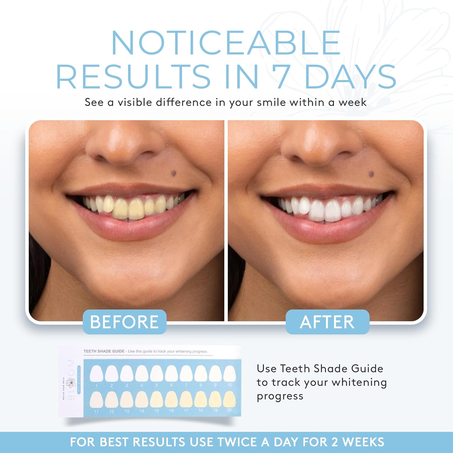 Bloom Teeth Whitening Kit 35% Carbamide Peroxide Gel 5X LED Light 10 Minute Daily No Sensitivity - Image 3