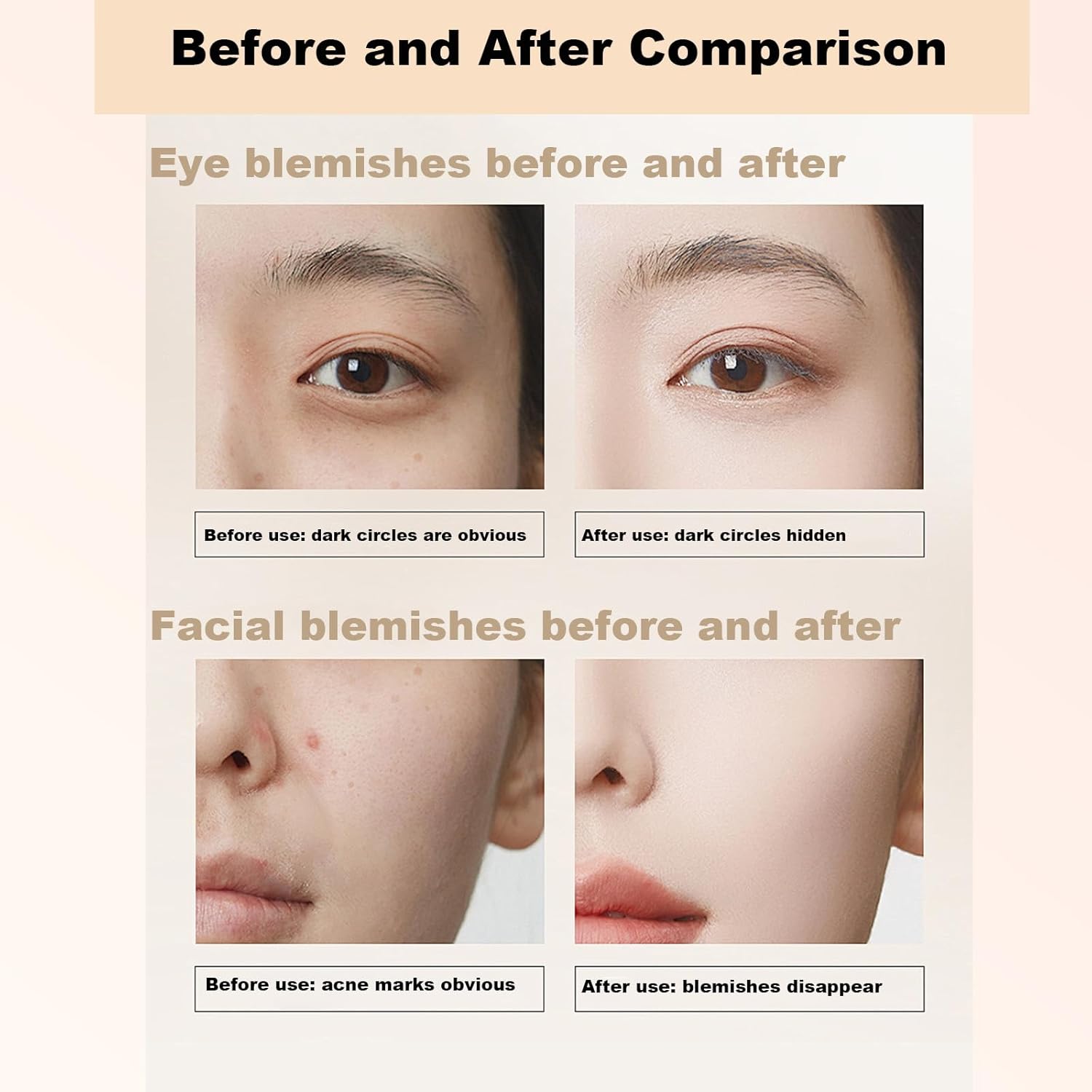 6-Color Correcting Concealer Palette for Dark Circles and Blemishes with 2 Included Brushes - Image 5