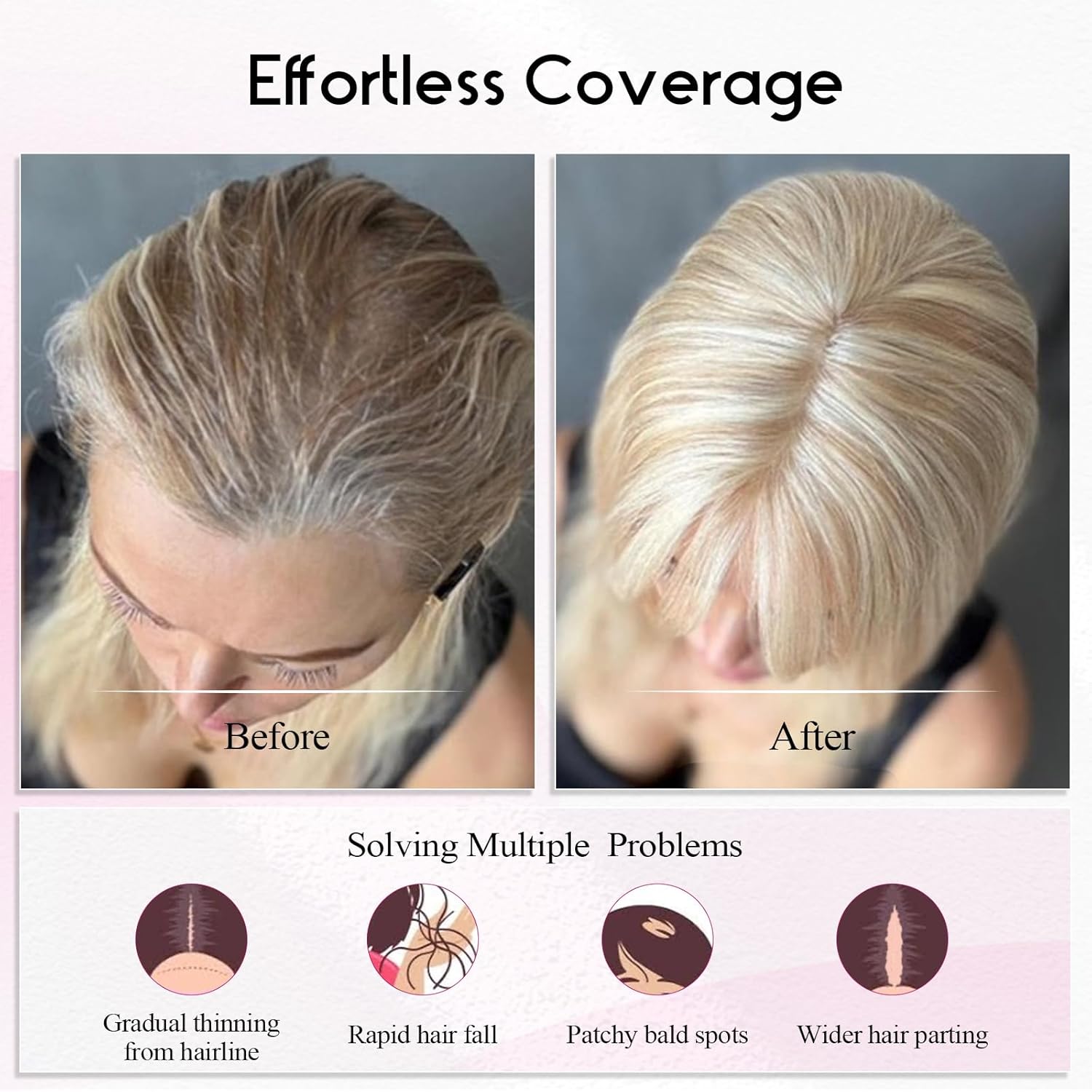 EMMOR 12 Inch Ombre Blonde Human Hair Topper, 5"x6" Big Base for Women - Image 6