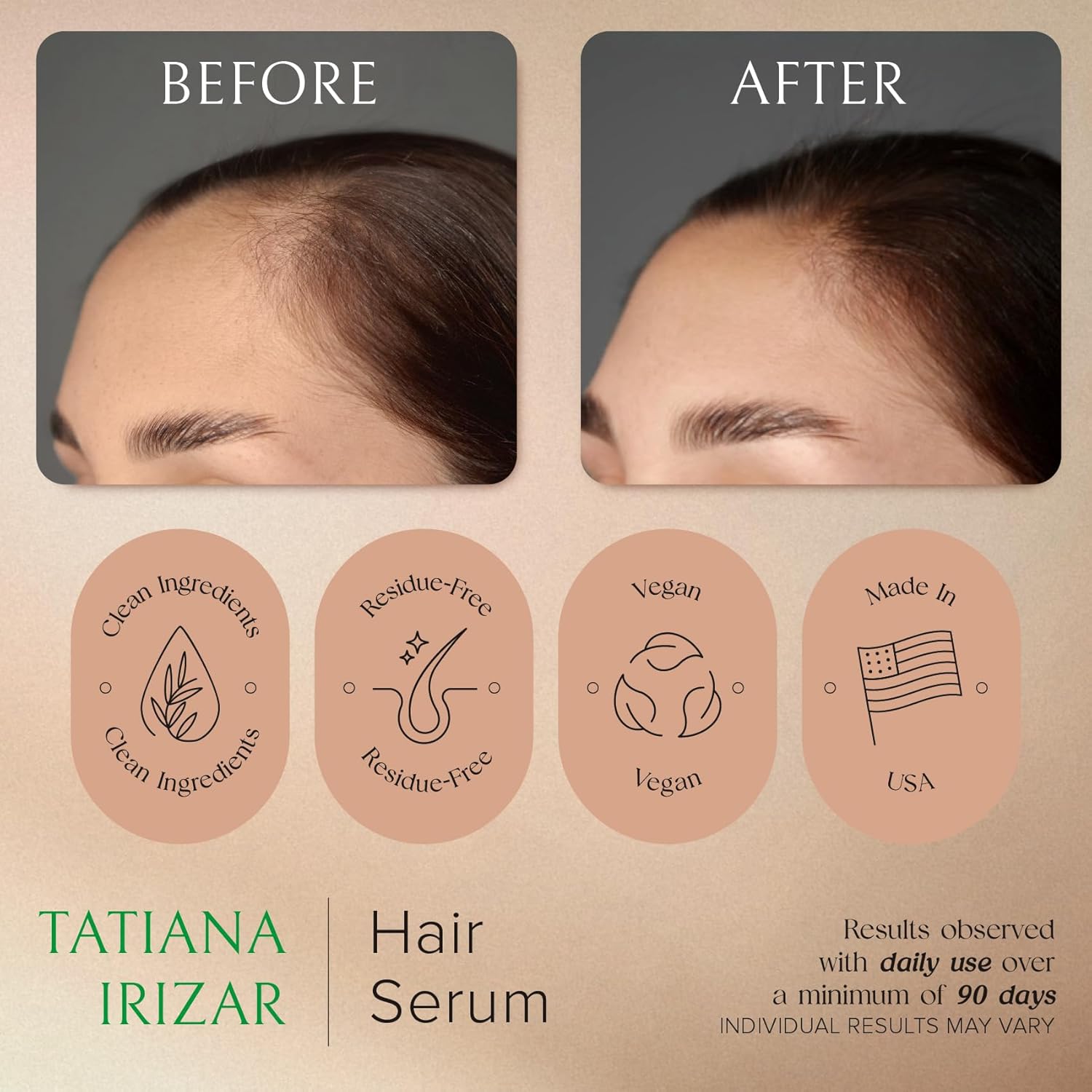 Rosemary Amla Hair Growth Serum for Women 2 Pack 1 Oz Each Non-Greasy Scalp Treatment - Image 7