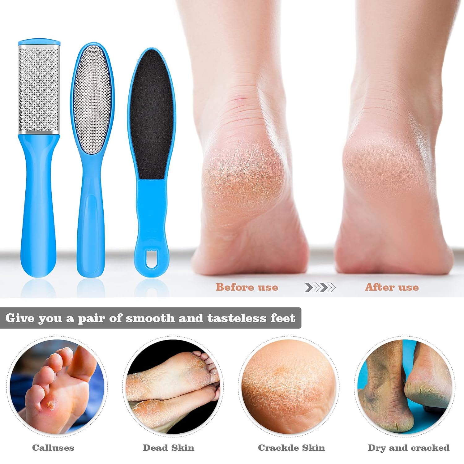 23-in-1 Professional Blue Pedicure Kit with Callus Remover and Stainless Steel Tools for Home Spa Use - Image 5
