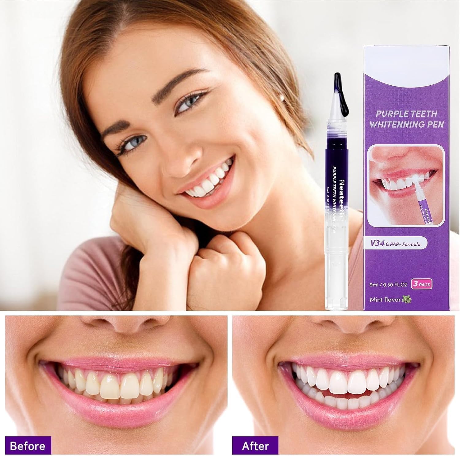 Purple Teeth Whitening Pen Set 3 Pack Instant Gel for Easy Stain Removal - Image 2
