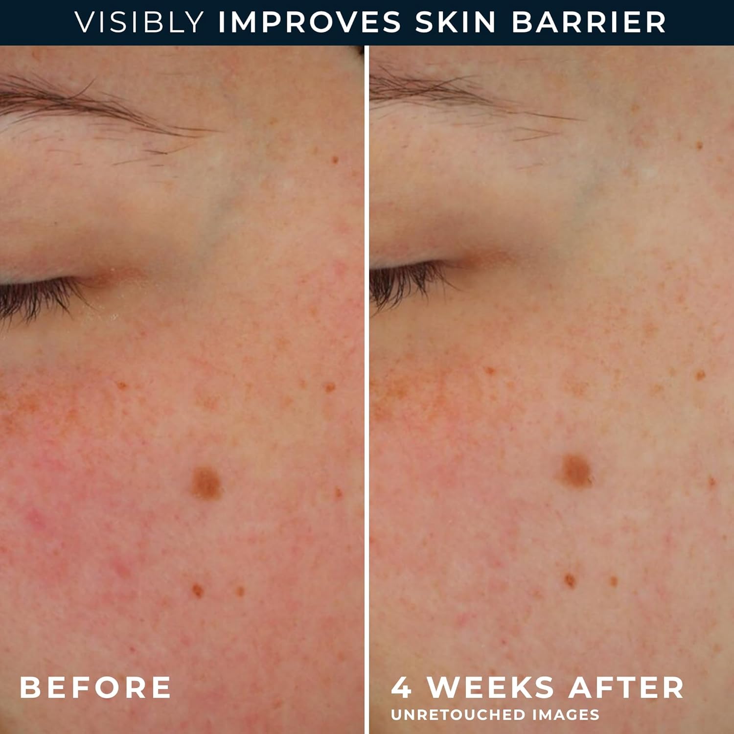 RoC Barrier Renew Day Cream SPF 30 2.5 oz with Ceramides, Prebiotics, and Retinol Eye Cream Packette - Image 5