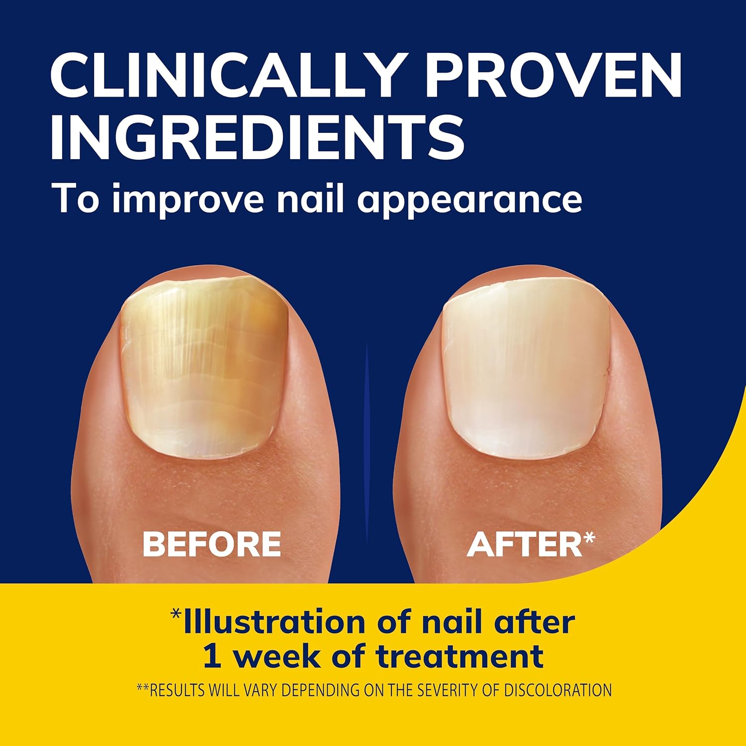 Dr. Scholl's 10ml Fungal Nail Revitalizer Liquid Treatment for Healthy Nails - Image 3
