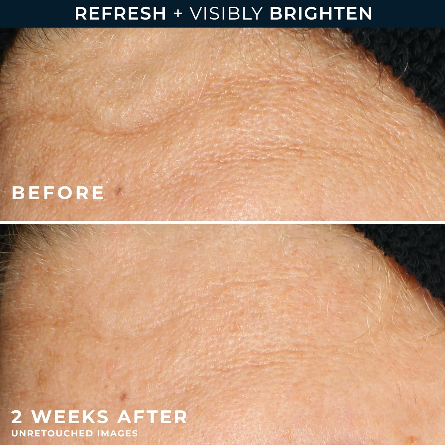 RoC Multi Correxion Revive + Glow Gel Facial Cleanser 6 Ounces Vitamin C Glycolic Acid - Image 5