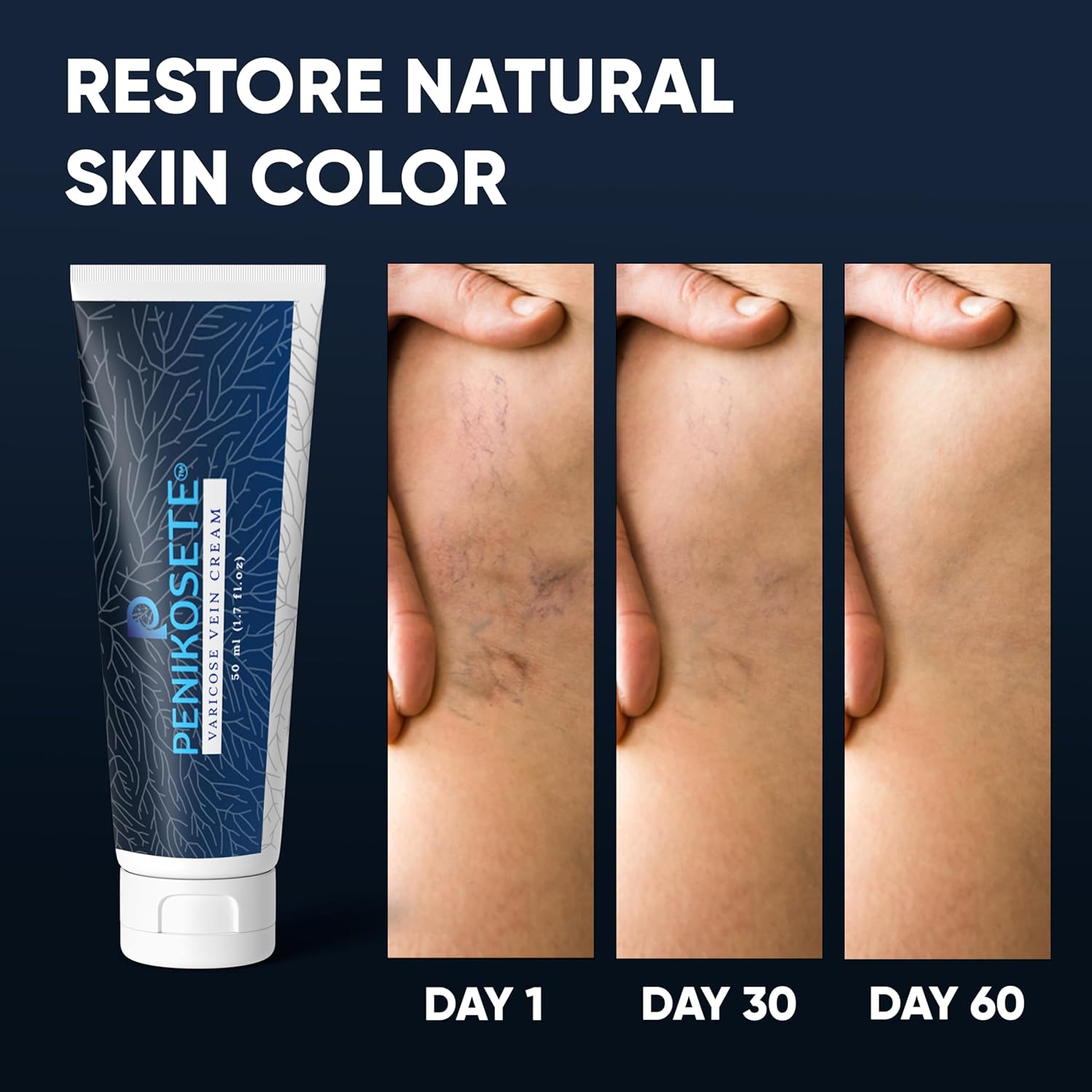 Ayurvedic Ashwagandha Cream for Varicose Veins Treatment and Leg Circulation Relief - Image 6
