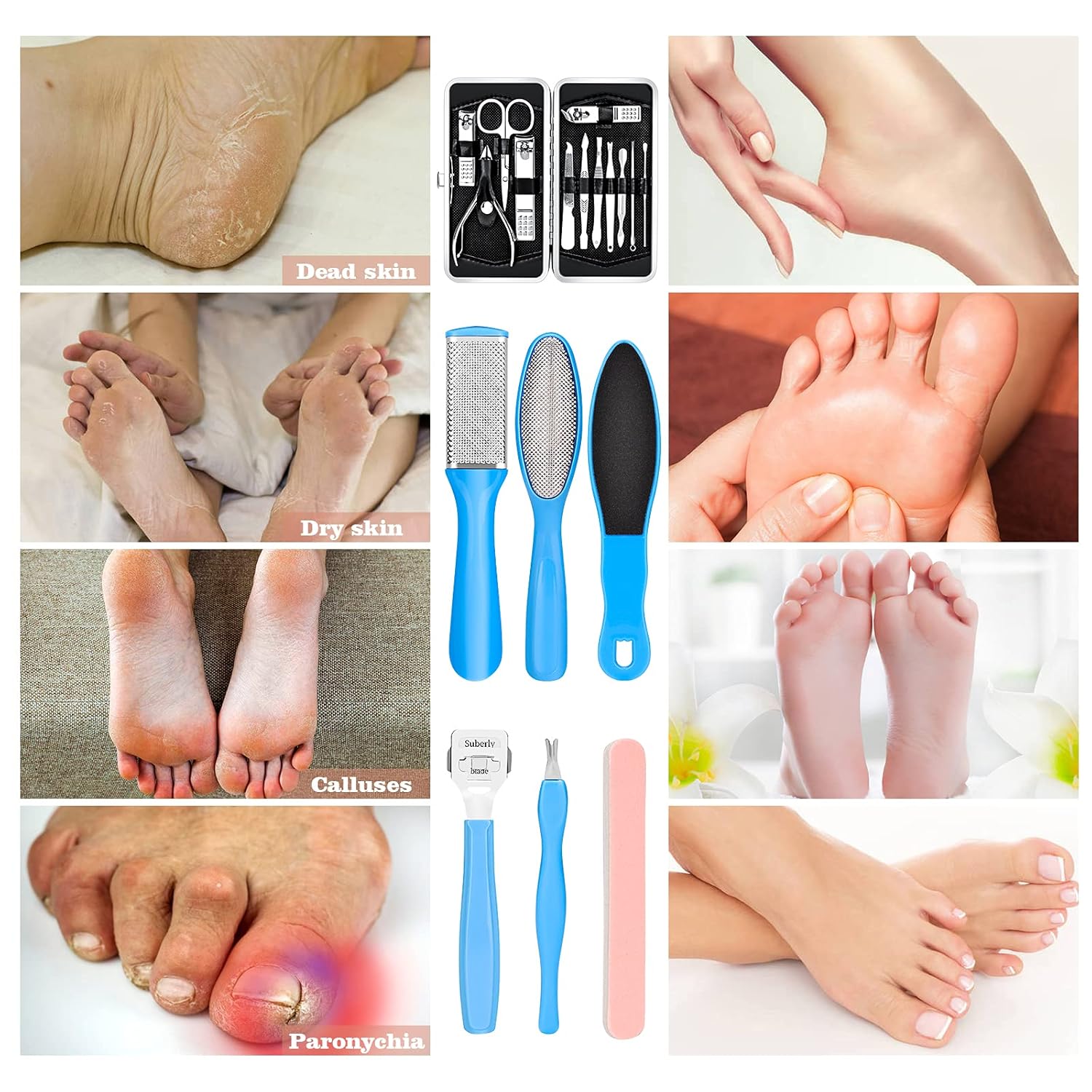 23-in-1 Professional Blue Pedicure Kit with Callus Remover and Stainless Steel Tools for Home Spa Use - Image 6