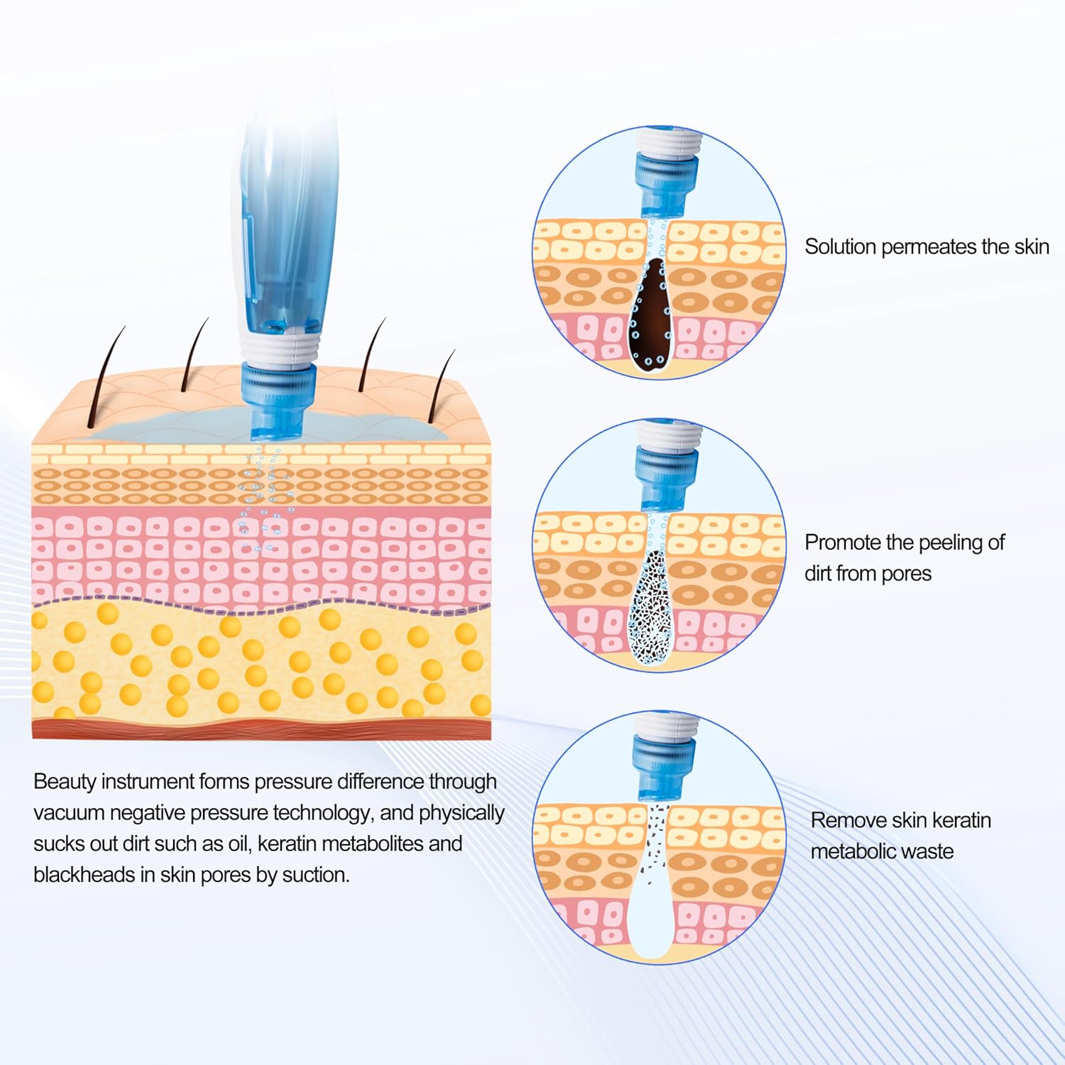 Hydradermabrasion Facial Machine Skin Peel Water Treatment ETWD007 Model 1 Liter Capacity - Image 5