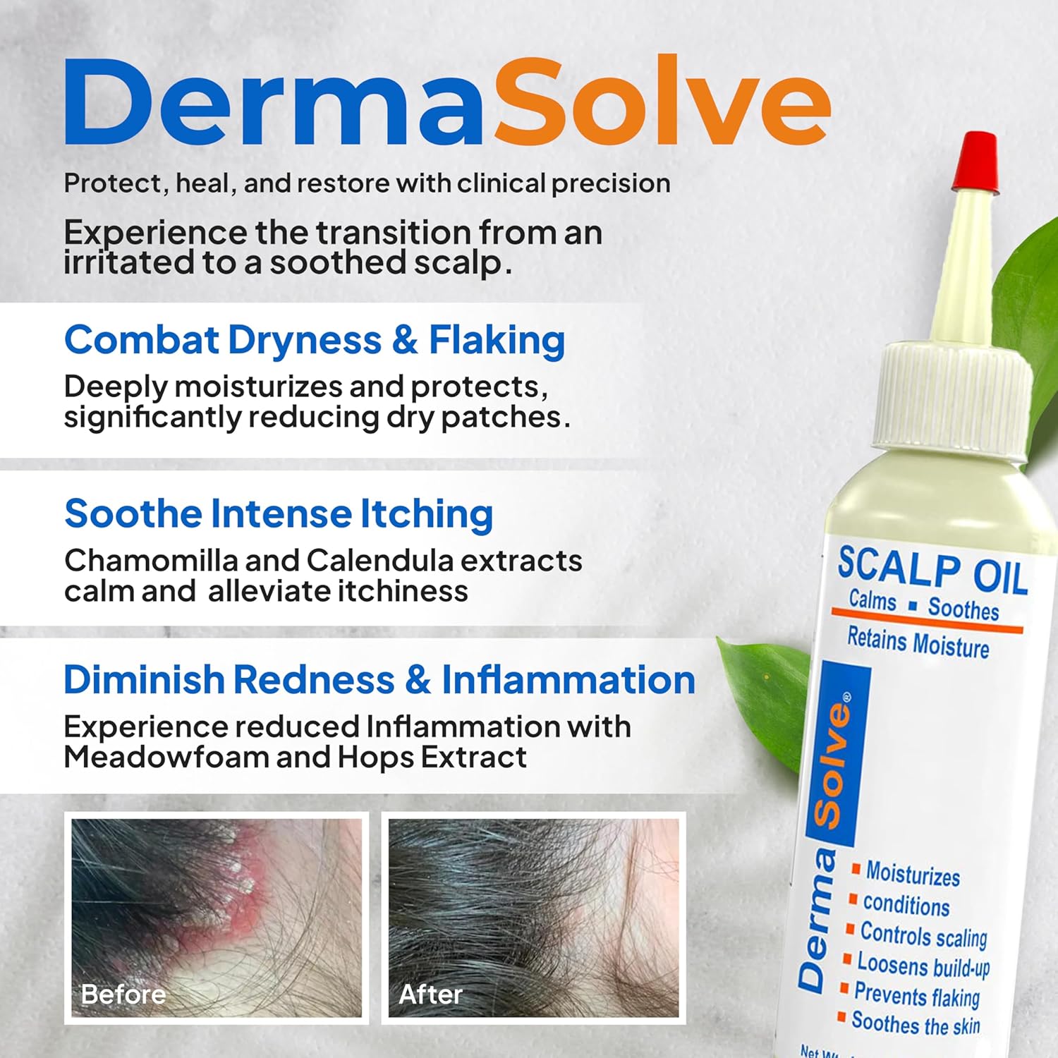 Dermasolve 4 oz Scalp Oil for Psoriasis, Seborrheic Dermatitis, and Dandruff Relief - Image 2