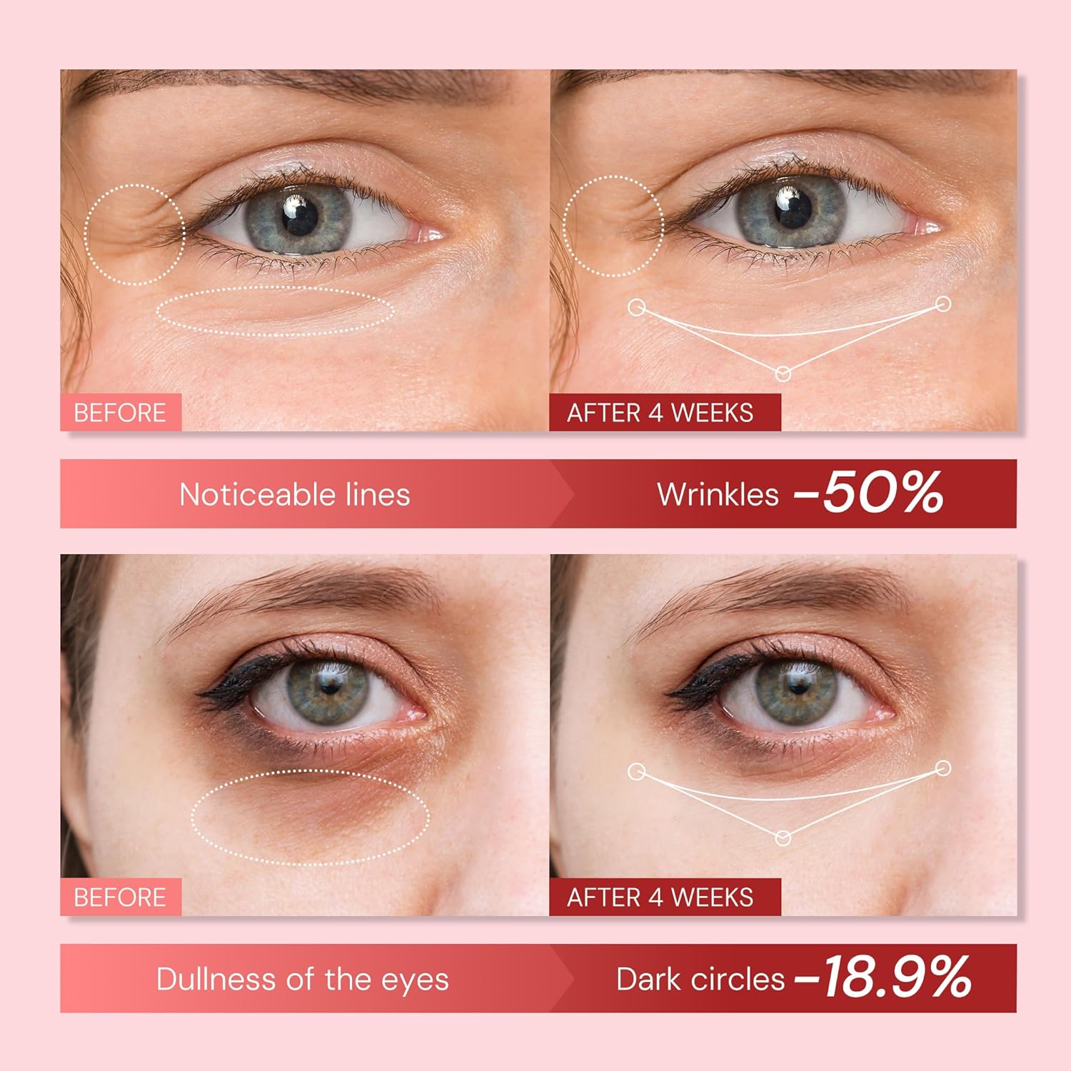 Retinol Polypeptide Anti-Aging Eye Cream for Wrinkle and Dark Circle Reduction 0.85 Fl Oz - Image 2