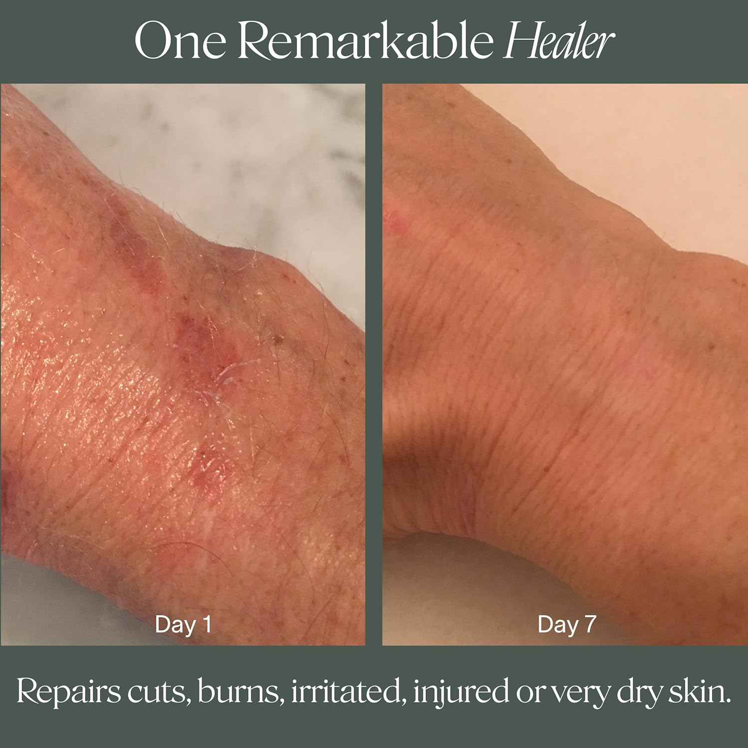 Doctor Rogers Restore Healing Balm 0.5oz Tube for Eczema Relief and Skin Protection - Image 6
