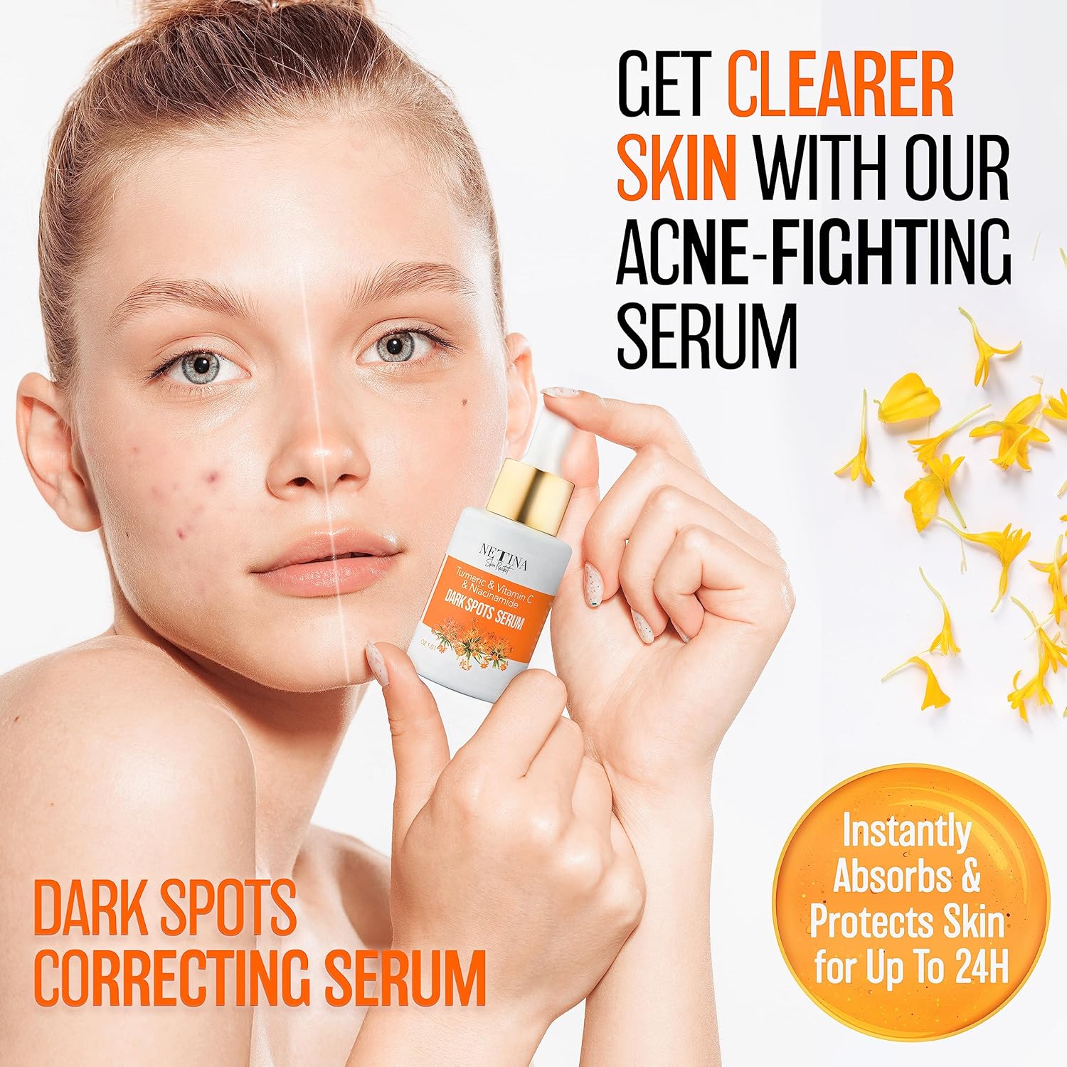 NETINA SKIN RESTART 30ml Vitamin C Brightening Serum for Dark Spots with Niacinamide Turmeric - Image 2