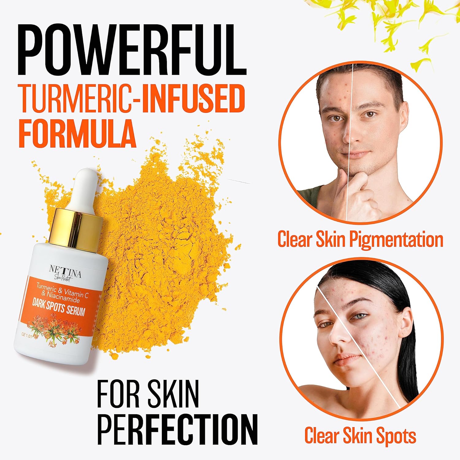 NETINA SKIN RESTART 30ml Vitamin C Brightening Serum for Dark Spots with Niacinamide Turmeric - Image 9