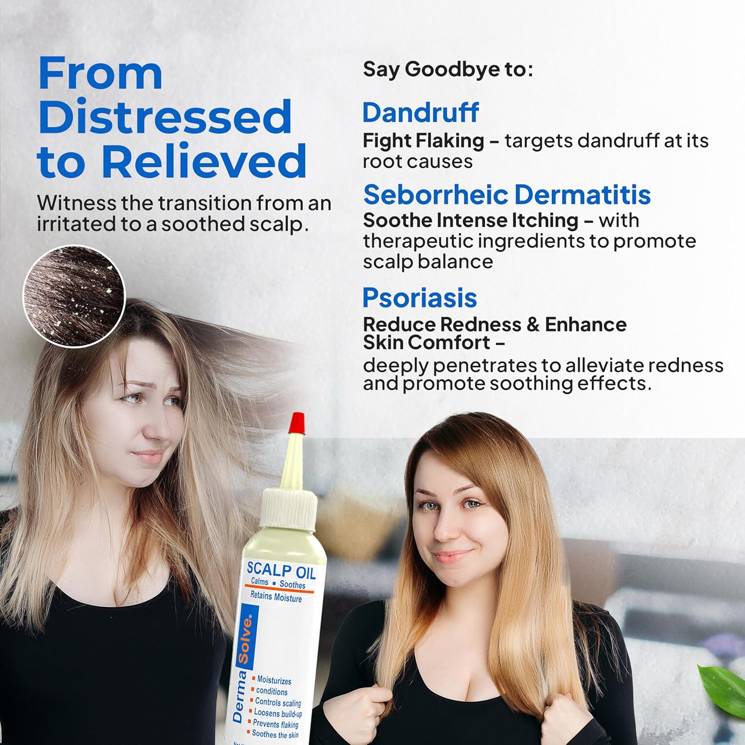 Dermasolve 4 oz Scalp Oil for Psoriasis, Seborrheic Dermatitis, and Dandruff Relief - Image 8