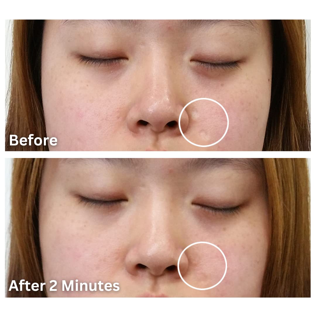 Dermaflage Medium Cool Scar Filler Kit Waterproof Concealer 1 Month Supply - Image 5