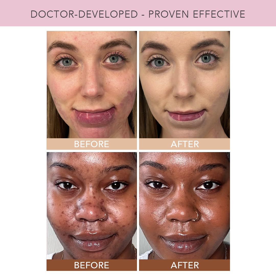 Doll 10 TCE Liquid Filter Lightweight Tinted CC Cream Foundation Moisturizer 30ml Vegan - Image 4