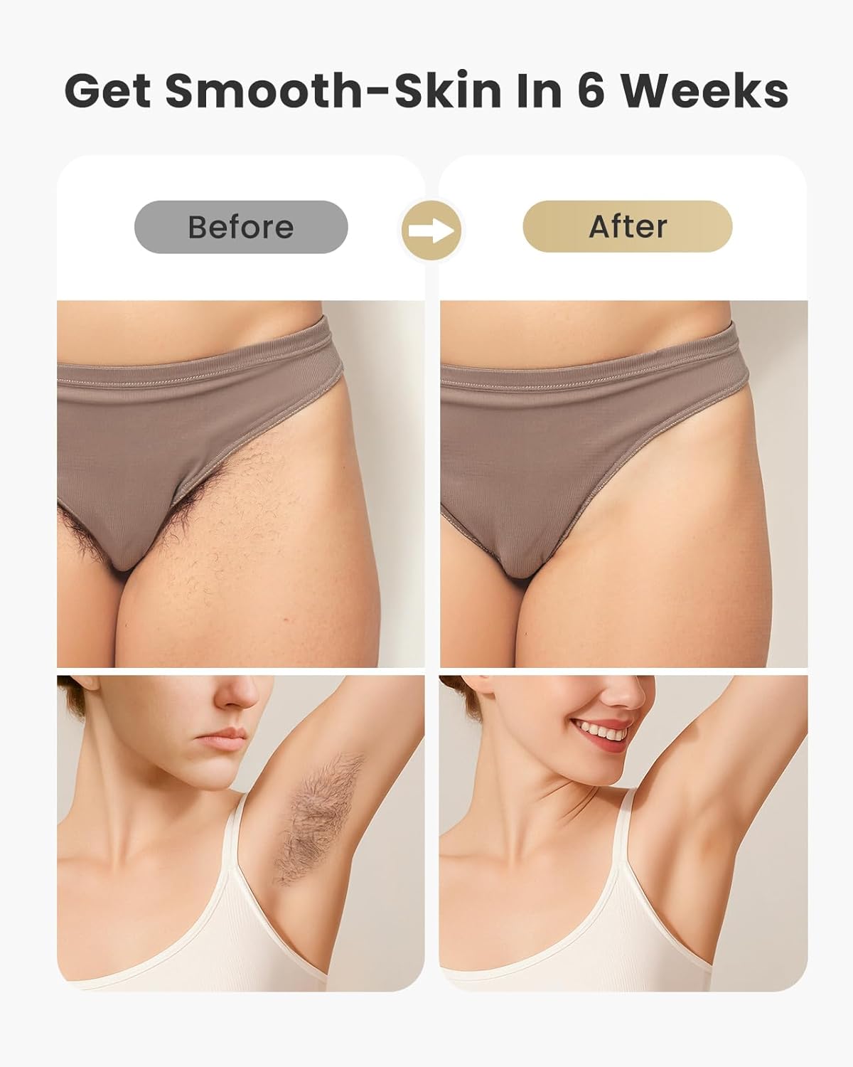 Nearly Painless IPL Laser Hair Removal Device for Home Use, 5.2cm² Area, Effective in 14 Days - Image 5
