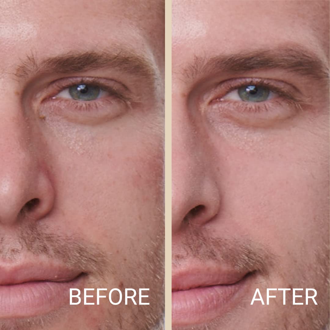 MATTR Skin Fix Tinted Concealer for Men 15g Vegan Formula for Blemishes and Fine Lines - Image 4