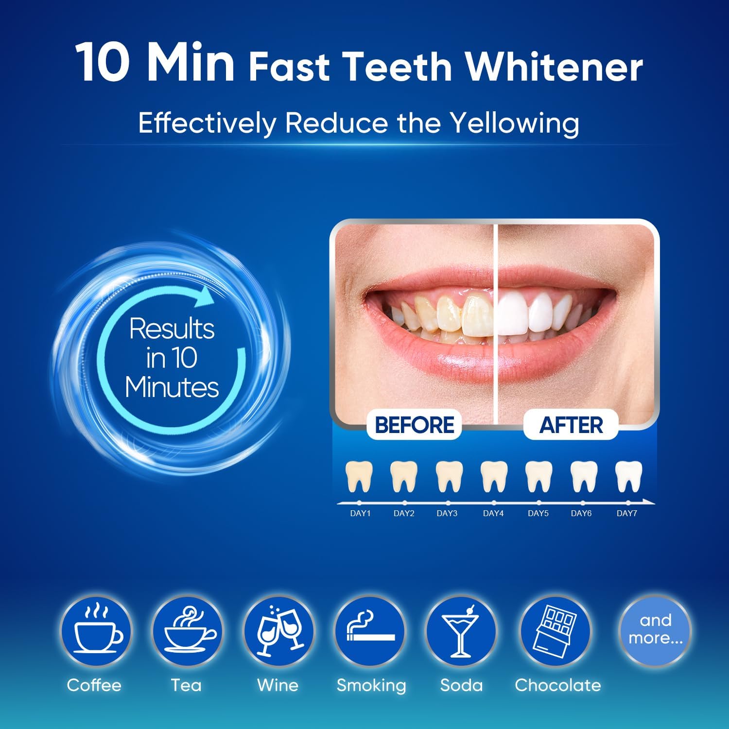 MySmile Sensitive Teeth Whitening Kit with LED Light and 9 Whitening Gel Tubes - Image 2