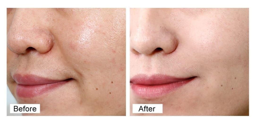 Retinol Plus+ Anti-Aging Firming Day & Night Moisturizer 1.7 Fl Oz with Vitamin E - Image 2