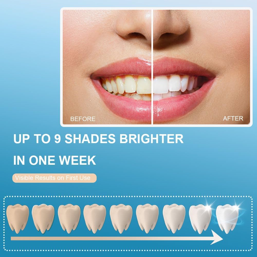 Sensitive Teeth Whitening Kit with LED Light, Gentle Gel Syringes, Blue - Image 2
